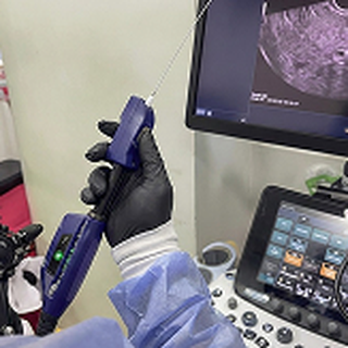 Clinical Trial & TPT
